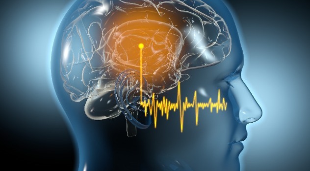Raffigurazione 3D delle onde sonore che arrivano al cervello