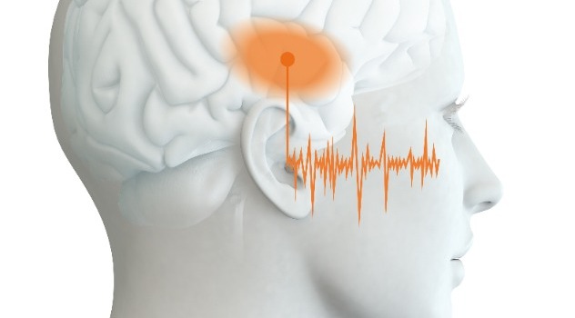 Raffigurazione 3D testa femminile di profilo con onde sonore percepite dal cervello